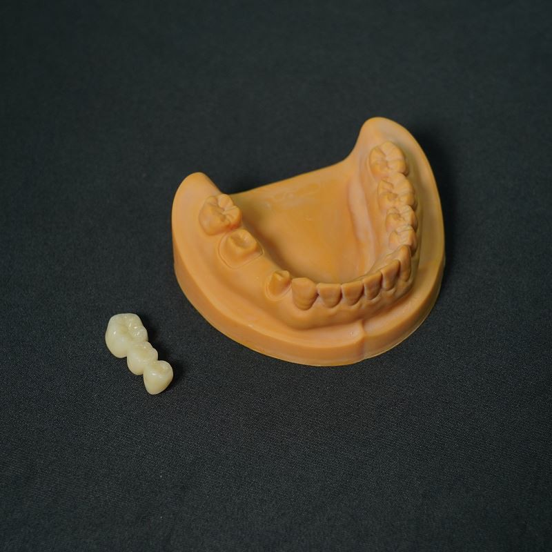 Cobalt-chrome Porcelain Teeth